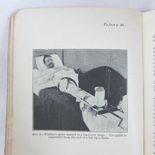 Memorandum on the Treatment of Injuries in War (1915)